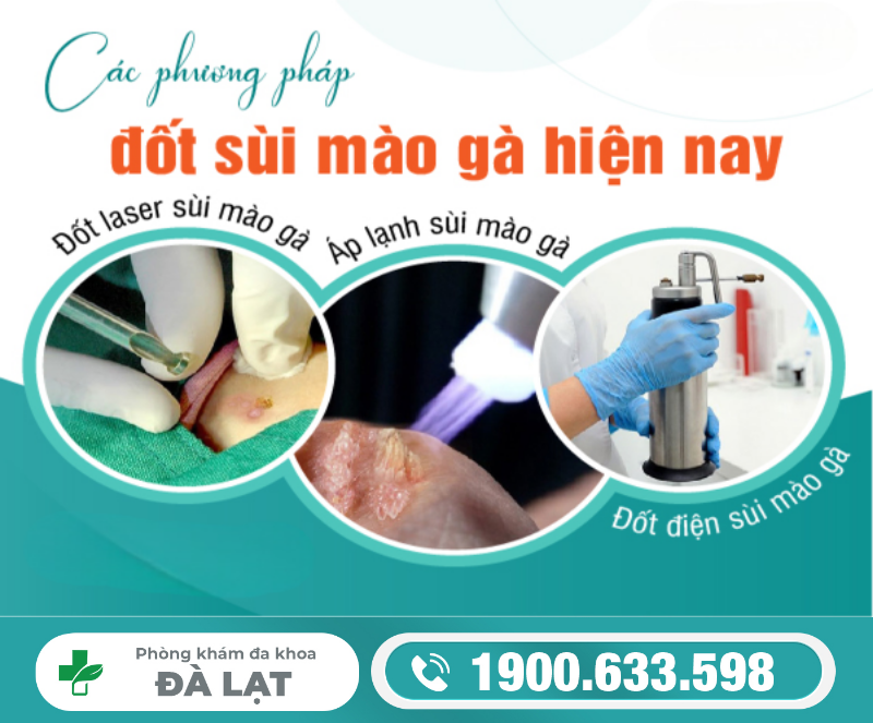 Hình ảnh minh họa